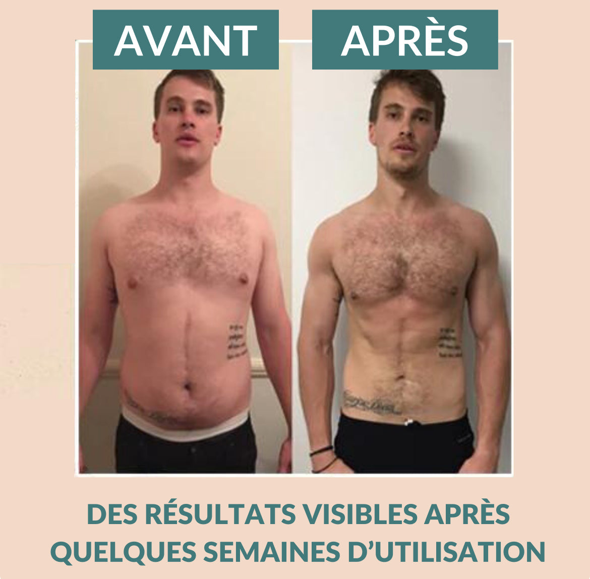 Patch Minceur Détox™️