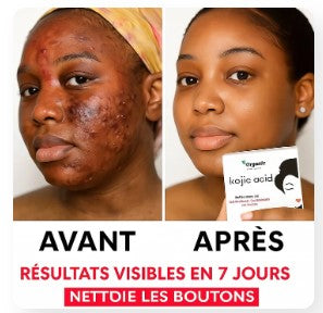 🧼Packt Savons Kojic –Purifie, Nettoie et Illumine Visiblement la Peau