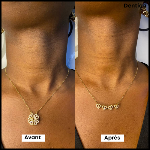 Collier Acheté = ( Bracelet + Coffret) Offerts + Livraison Gratuite