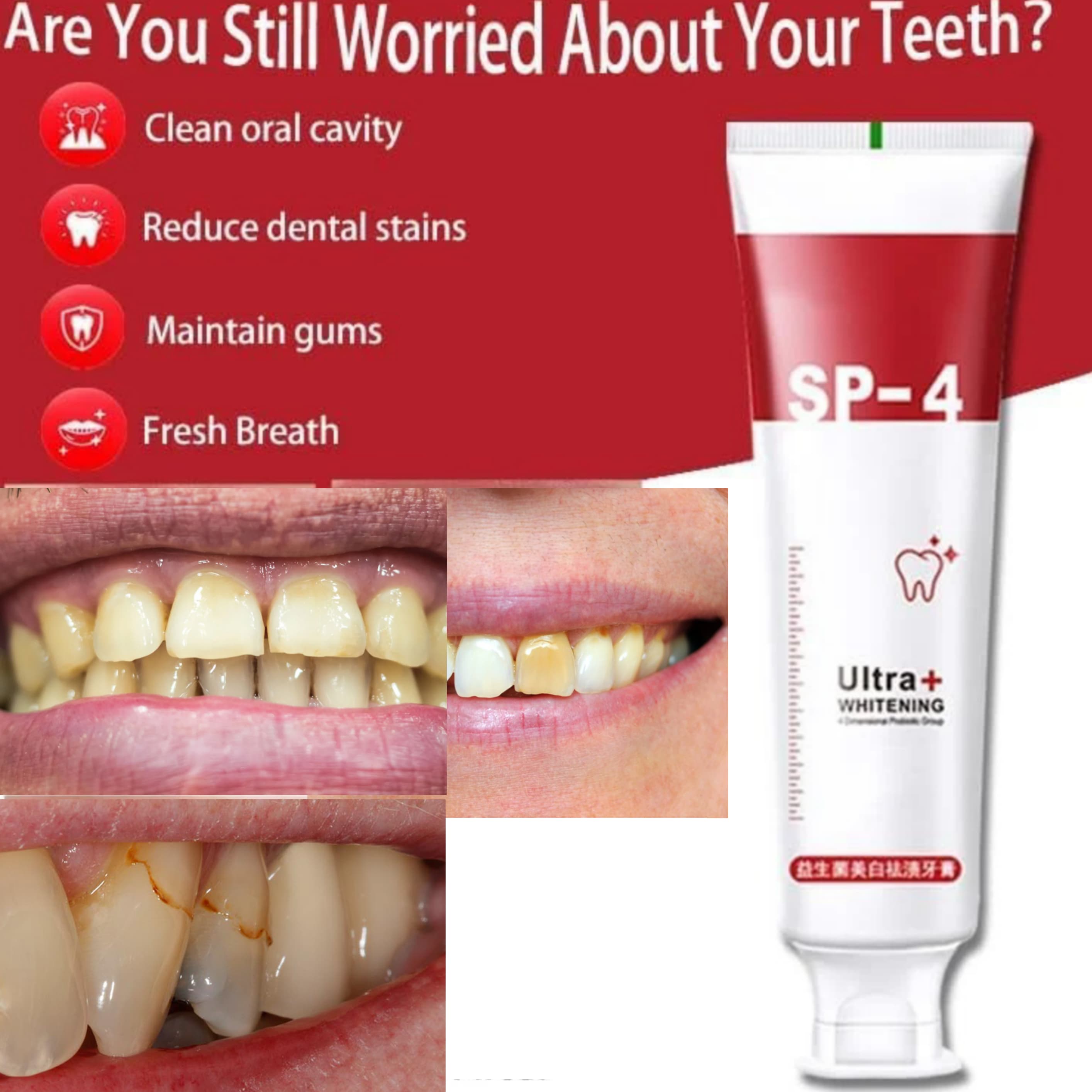 SP-4 Dentifrice blanchissant probiotique Gestion de la santé bucco-dentaire(Élimine des années de taches)