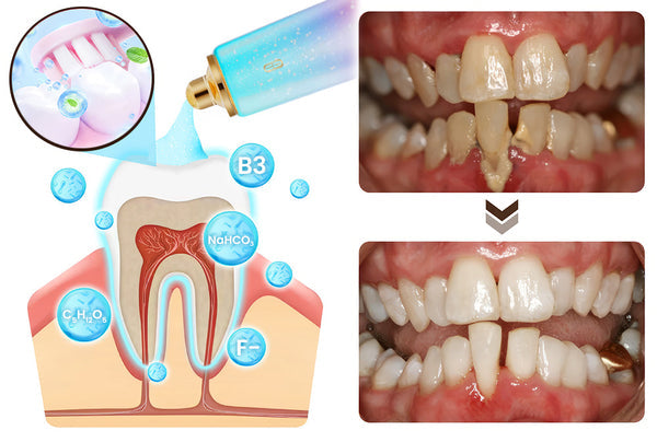 🦷✨ DENTIFRICE BLANCHISSANT À LA NIACINAMIDE-sourire éclatant et une bouche saine au quotidien.