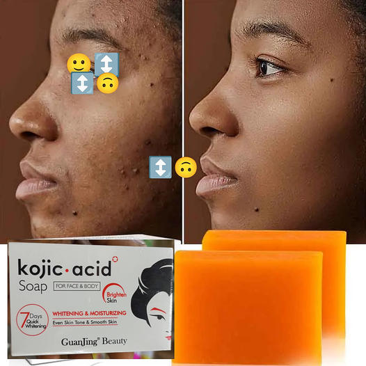 🧼Packt Savons Kojic –Purifie, Nettoie et Illumine Visiblement la Peau